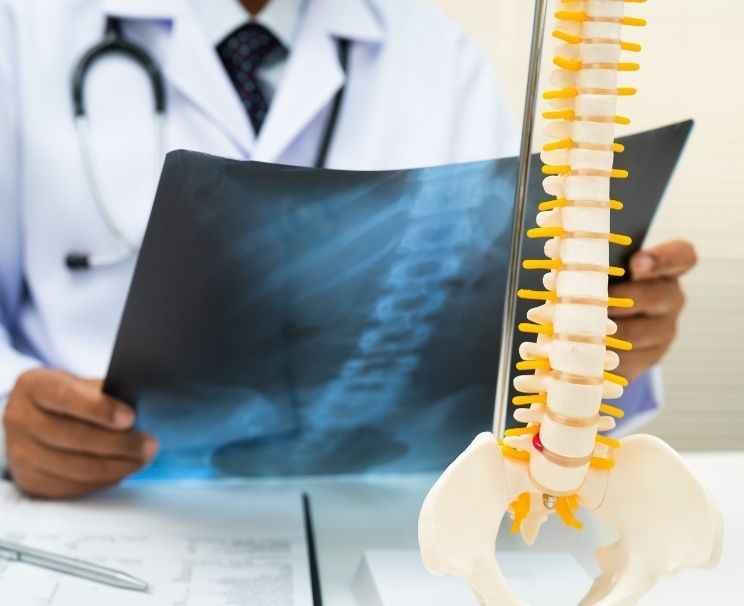 Bone Scan