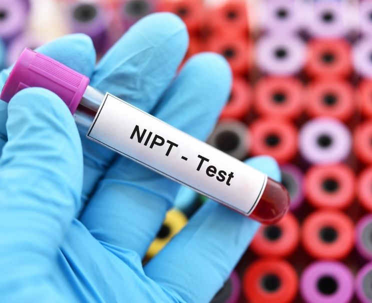 NIPT Testi