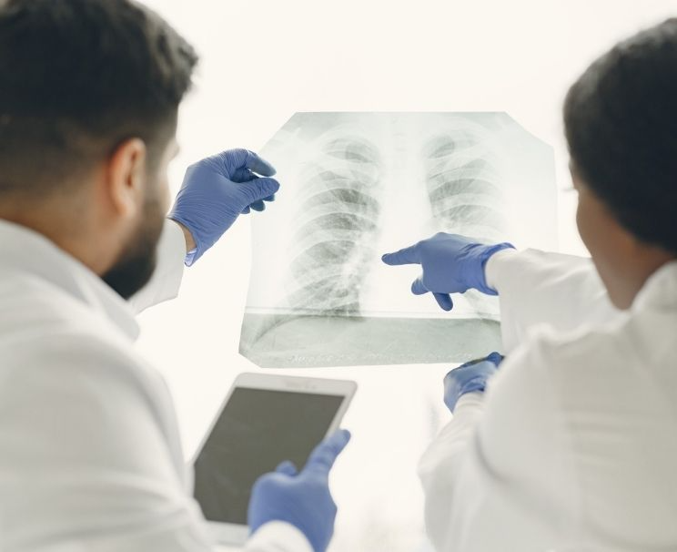 Akciğer Grafisi Nerede Çekilir