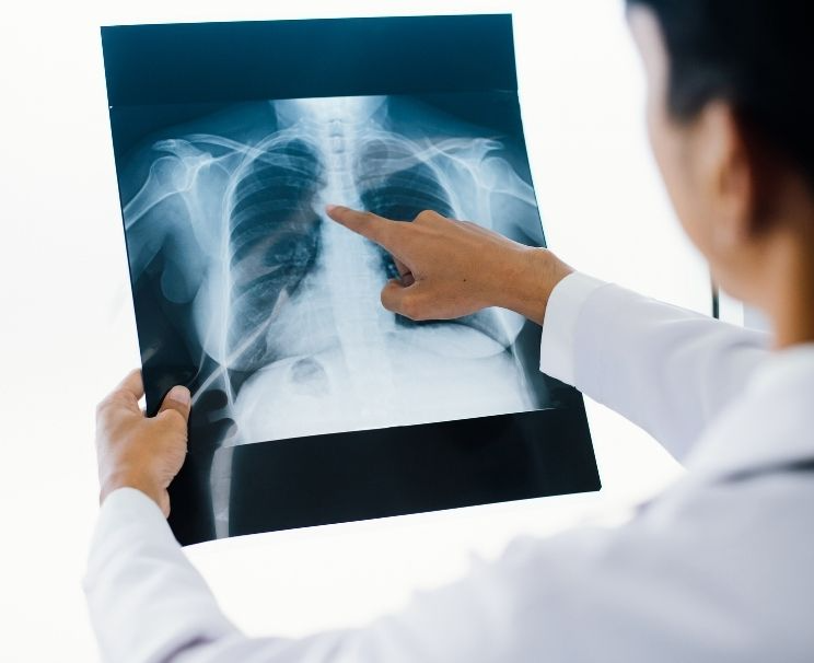 X-Ray Interpretation