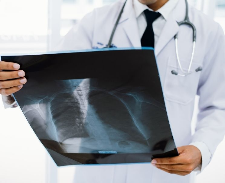 Where is a Chest X-Ray Taken