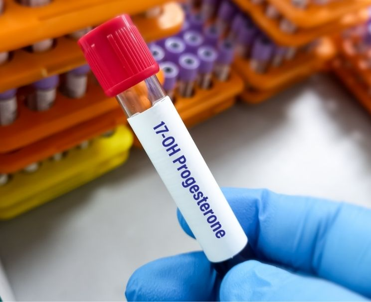 Progesteron Testi Nedir