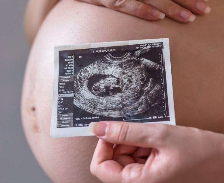 Fetal DNA Testi Ankara