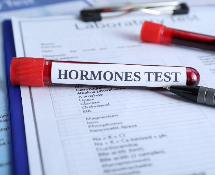Hormon Testi Fiyatları