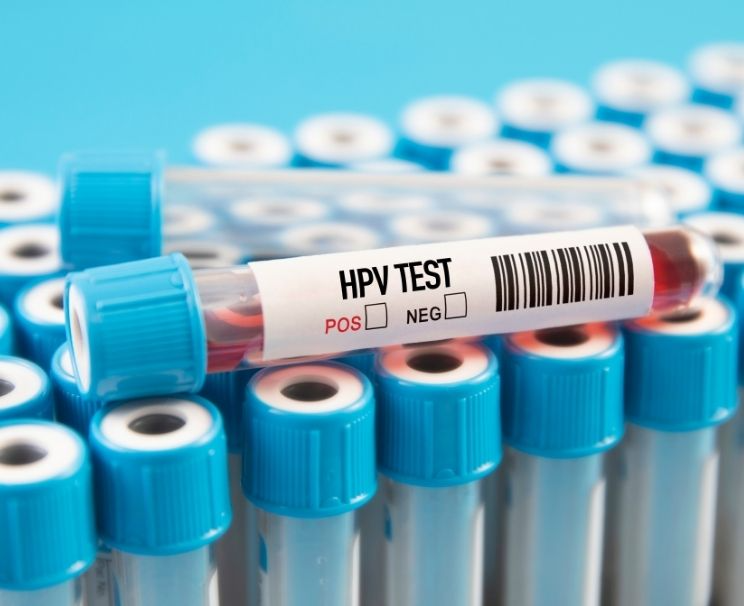 HPV Testi Nerede Yapılır?