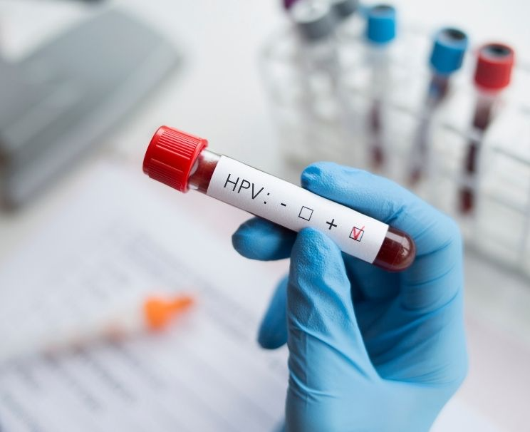 HPV Testi Nerede Yapılır?