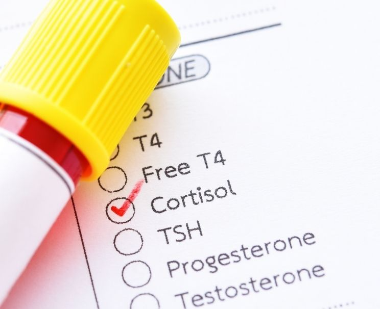 How to Lower Cortisol Levels?
